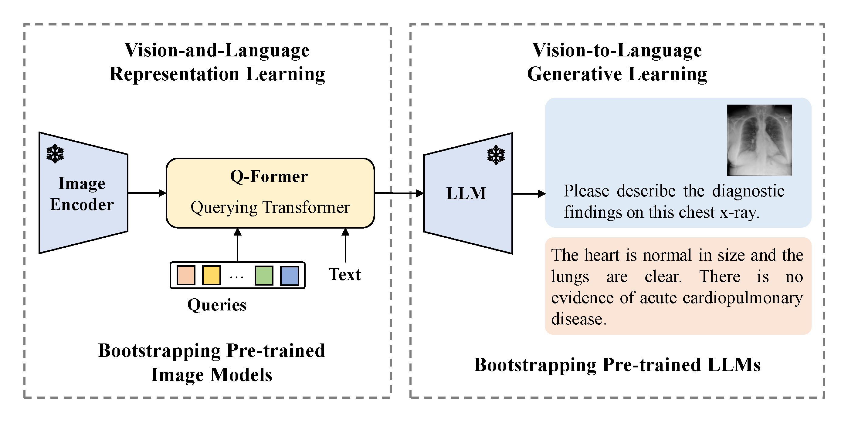 Figure 4: BLIP fine-tuning method