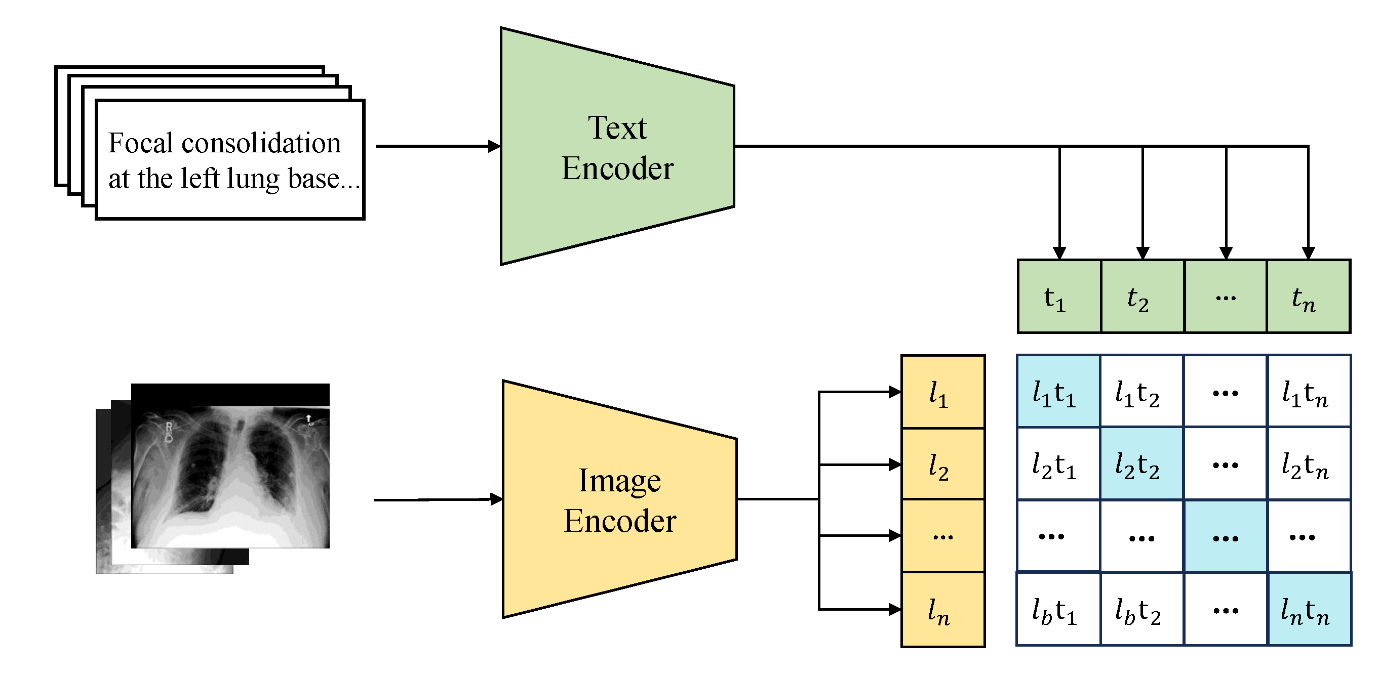 Figure 3: Contrastive learning multimodal pre-training technique